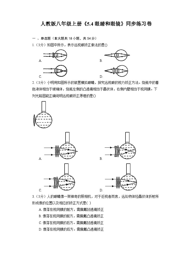 人教版八年级上册物理 《5.4 眼睛和眼镜》同步练习卷（含解析）01