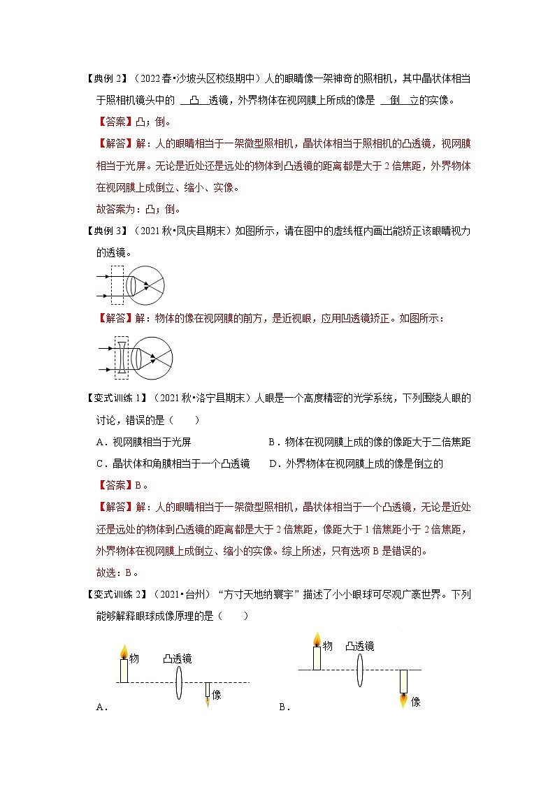 人教版八年级物理上册同步考点专题训练 5.4 眼睛和眼镜（原卷版+解析版）02