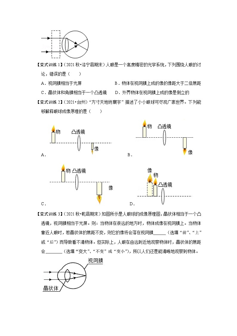 人教版八年级物理上册同步考点专题训练 5.4 眼睛和眼镜（原卷版+解析版）02