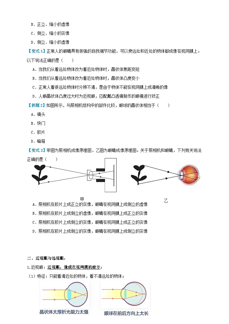 人教版八年级物理上册 5.4眼睛和眼镜（讲义）学生版+解析第2页