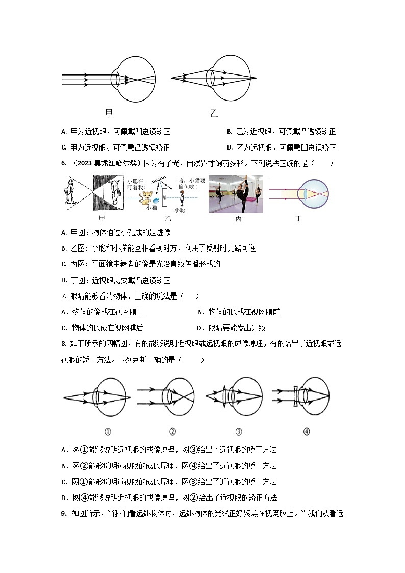 专题11 近视眼与远视眼中考考题（原卷版）第2页