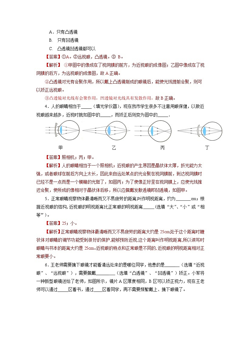 【核心素养】人教版八年级上册 第五章 第4节《眼睛和眼镜》课件+教案+分层练习02