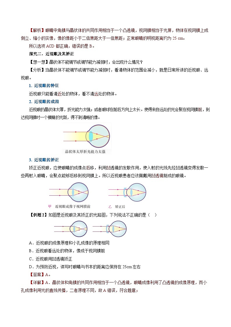 【人教版】八上物理 5.4 眼睛和眼镜（课件+教案+导学案+同步练习+内嵌视频）03