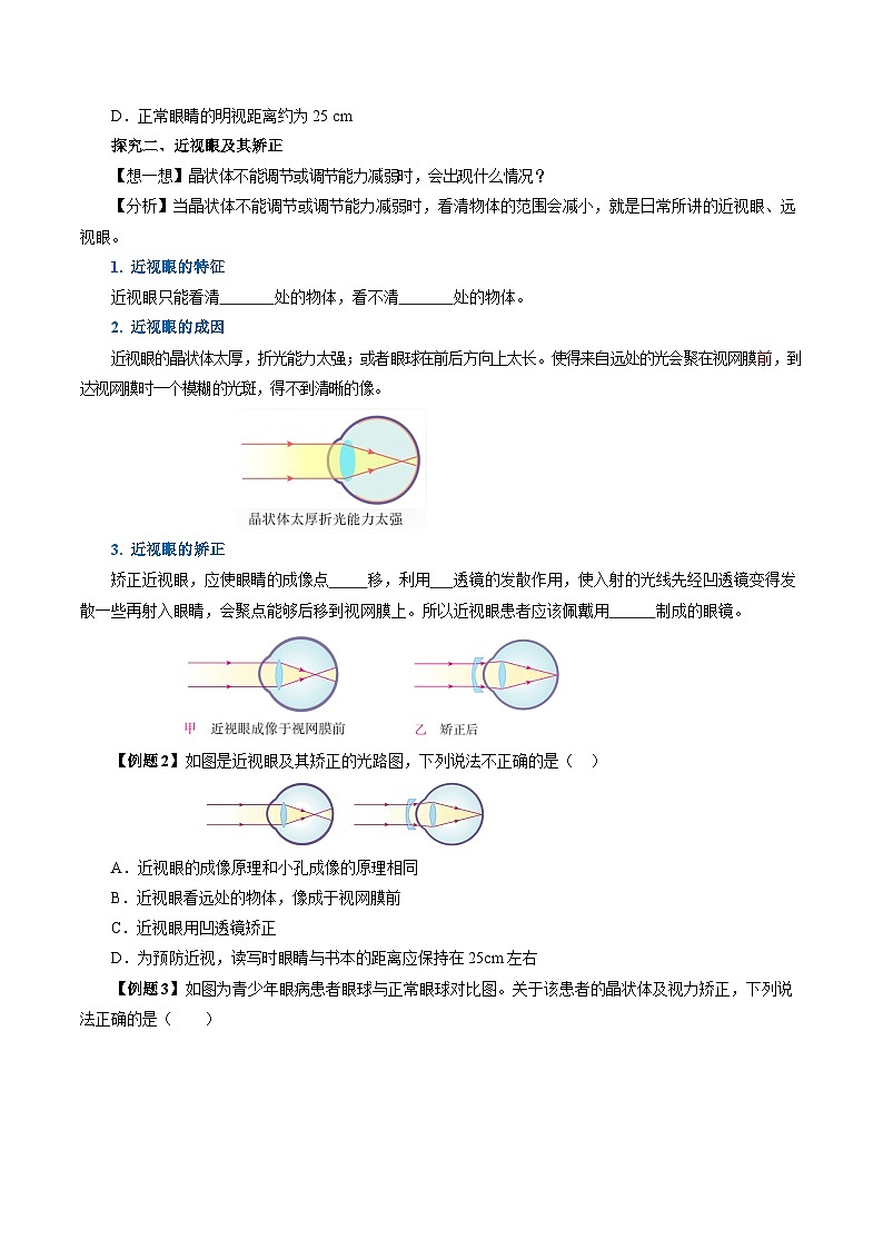 【人教版】八上物理 5.4 眼睛和眼镜（课件+教案+导学案+同步练习+内嵌视频）03