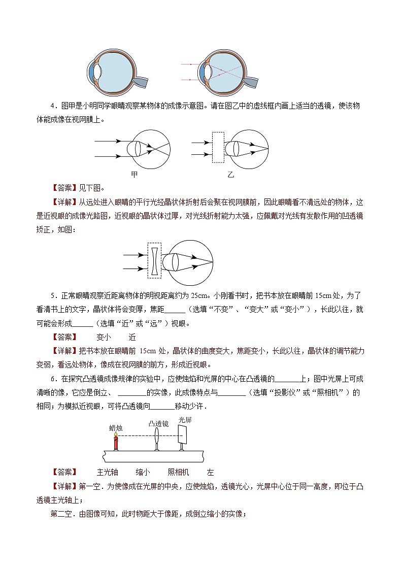 【人教版】八上物理 5.4 眼睛和眼镜（课件+教案+导学案+同步练习+内嵌视频）02