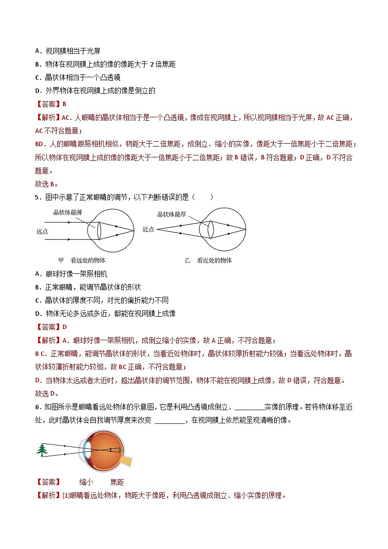 （人教版2024）八年级物理上册同步5.4 眼睛和眼镜   课件+教案+同步练习+视频素材03