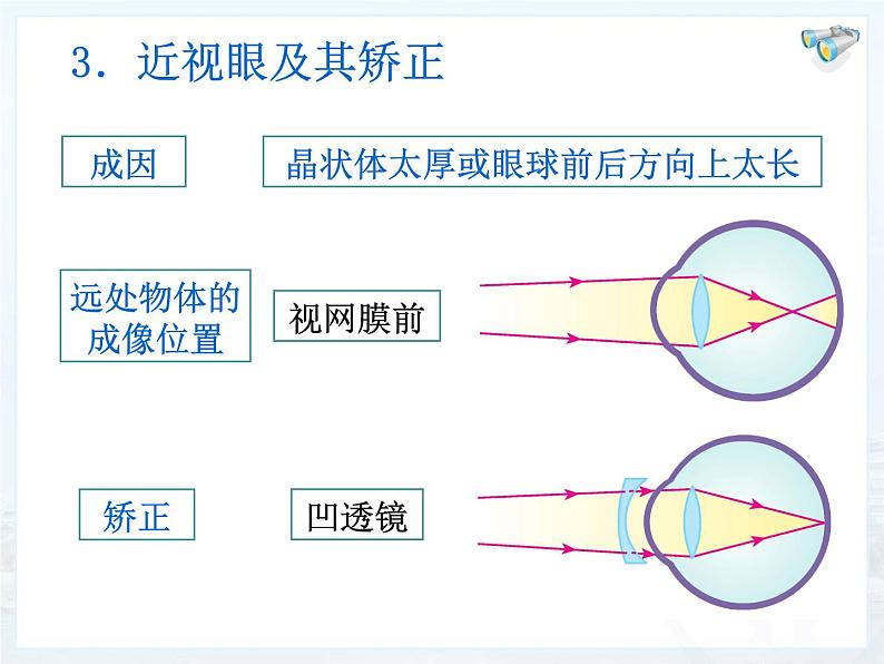 5.4眼睛和眼镜课件2024-2025学年人教版物理八年级上册07