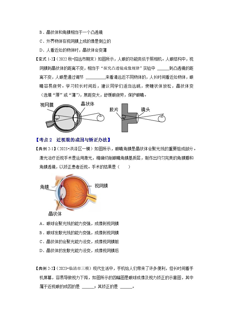 人教版物理八年级上册同步讲义+专题训练5.4 眼睛和眼镜（考点解读）（学生版）第3页