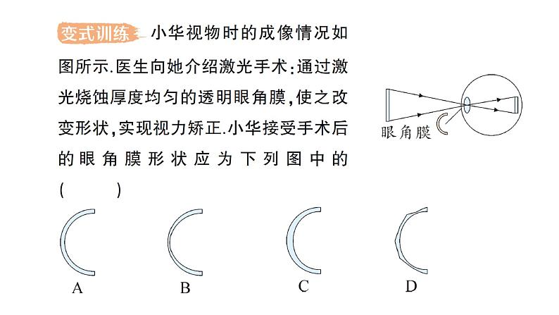 初中物理新人教版八年级上册第五章第四节 眼睛和眼镜作业课件2024秋第6页