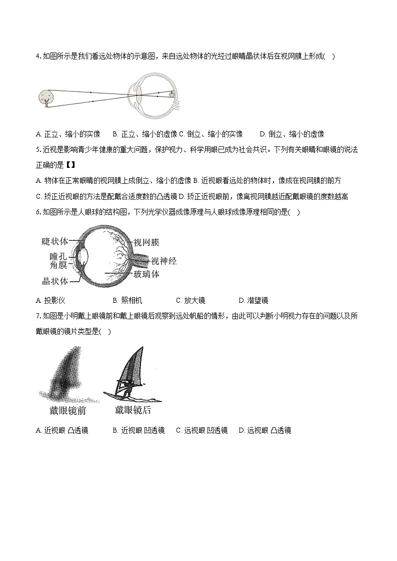 5.4 眼睛和眼镜 -同步练习 - 2025-2026学年人教版物理八年级上册(有答案）第2页