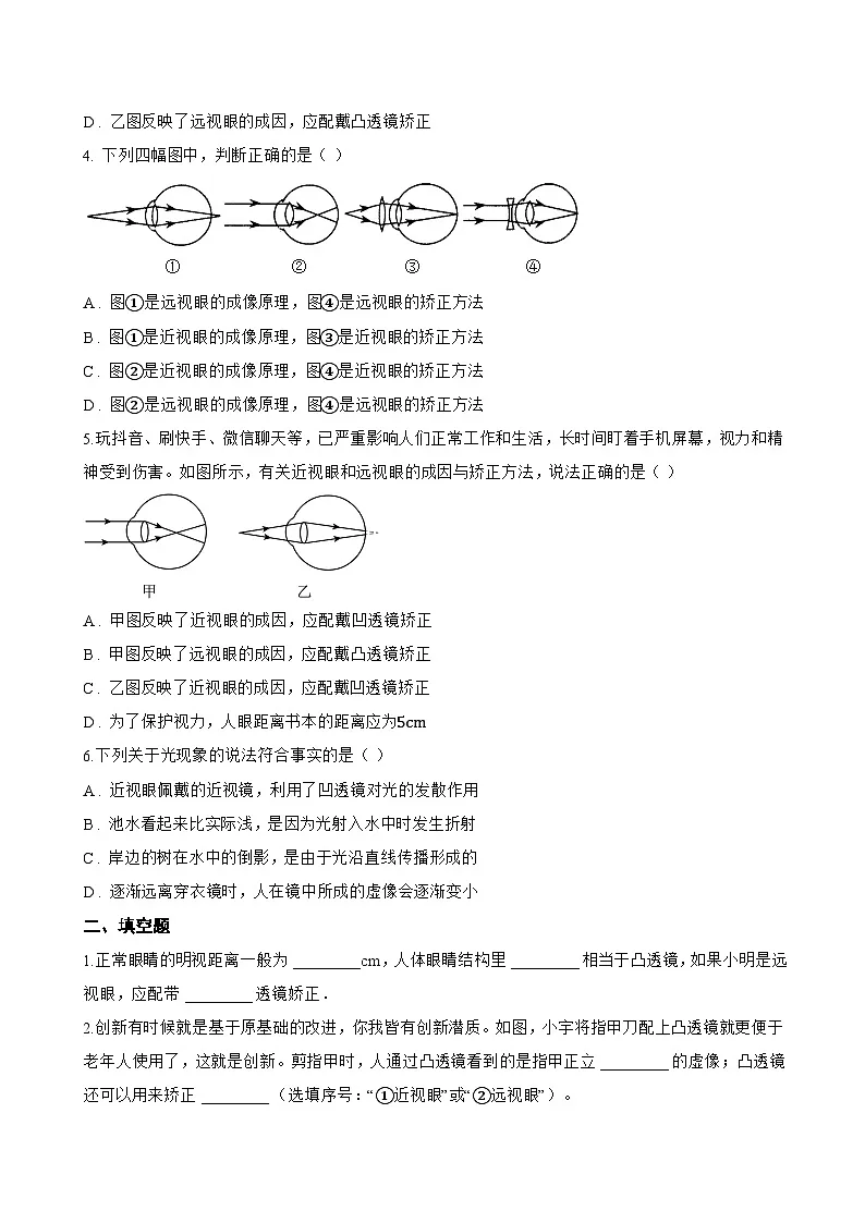 跨学科实践 用“水透镜”探究近视眼的形成原因一课一练物理沪粤版（2024）初中八年级上册(无答案)第2页