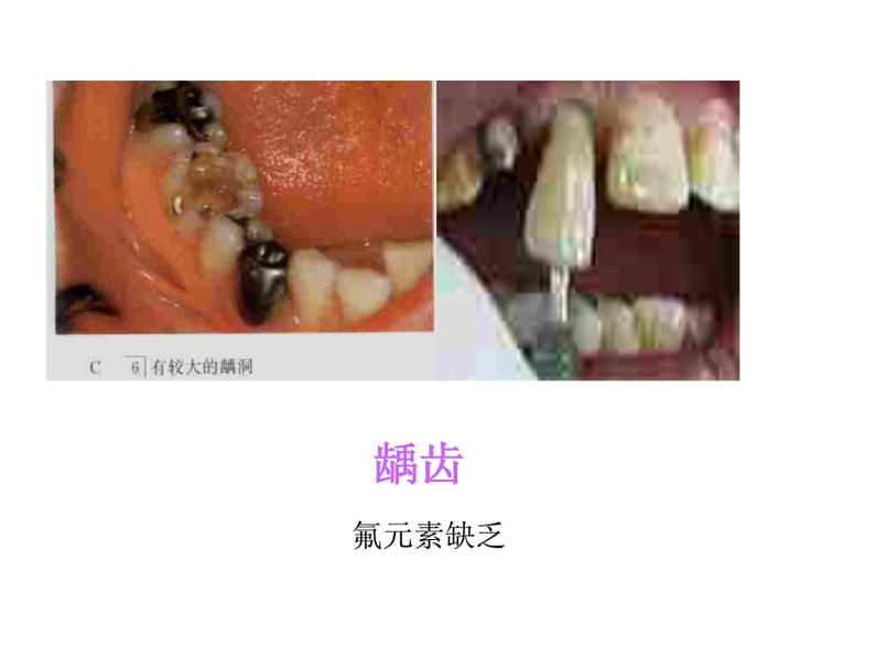 人教版九年级化学上册 3.3 元素（25）课件PPT第3页