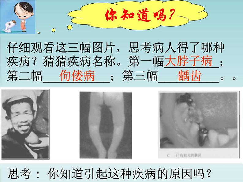 人教五四制初中化学九年级全册《第五单元 课题2 化学元素与人体健康》课件PPT02