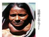 魯教版（五四制）九年級(jí)化學(xué) 5.2化學(xué)元素與人體健康 課件
