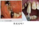 魯教版（五四制）九年級(jí)化學(xué) 5.2化學(xué)元素與人體健康 課件