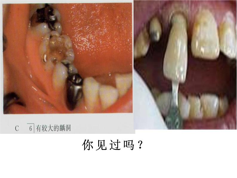 鲁教版（五四制）九年级化学 5.2化学元素与人体健康 课件05