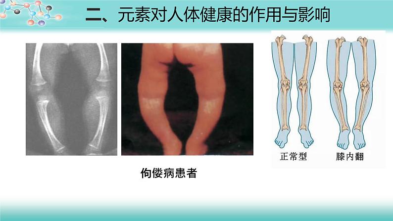 化学元素与人体健康-课件第8页