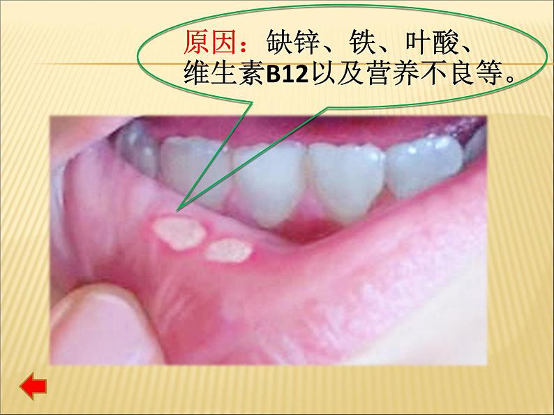 人教版化学九年级下册12.2《化学元素与人体健康》PPT课件2第6页