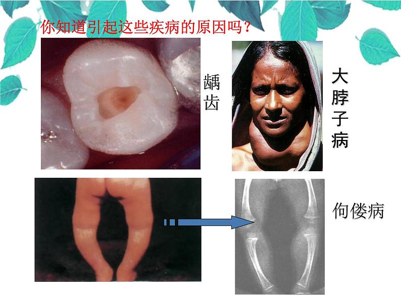 人教版化学九年级下册 第十二单元化学与生活课题2化学元素与人体健康-课件第2页