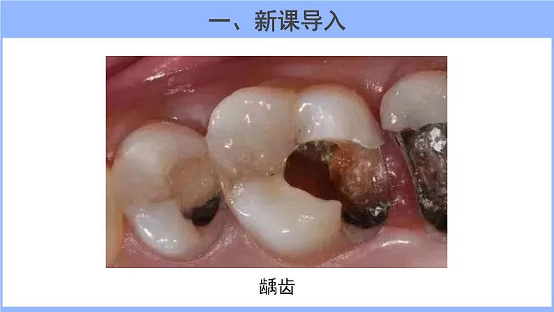 人教版化学九年级下册 12.2化学元素与人体健康课件第2页