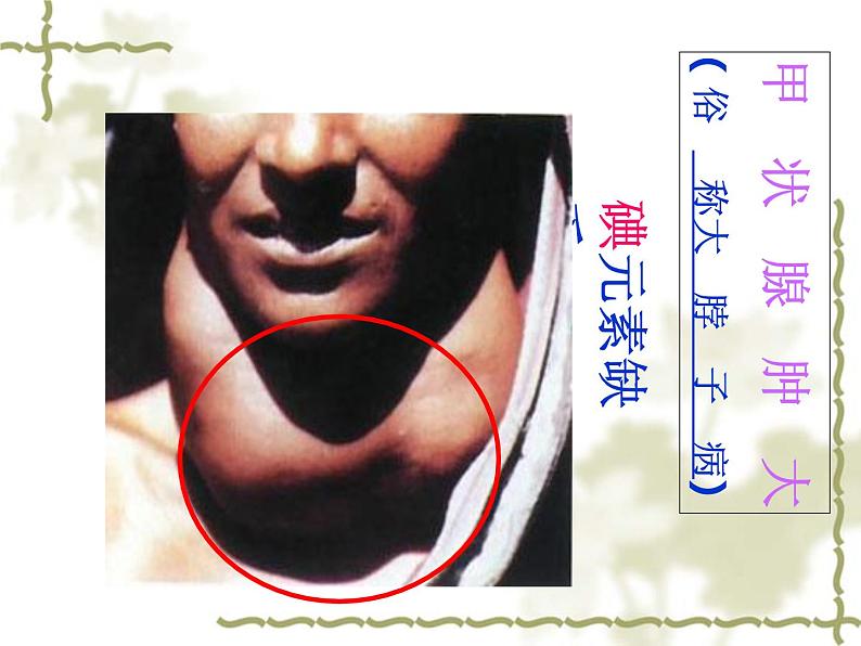 人教版初中化学九下12.2 化学元素与人体健康 课件03