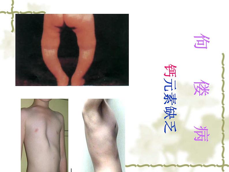 人教版初中化学九下12.2 化学元素与人体健康 课件04