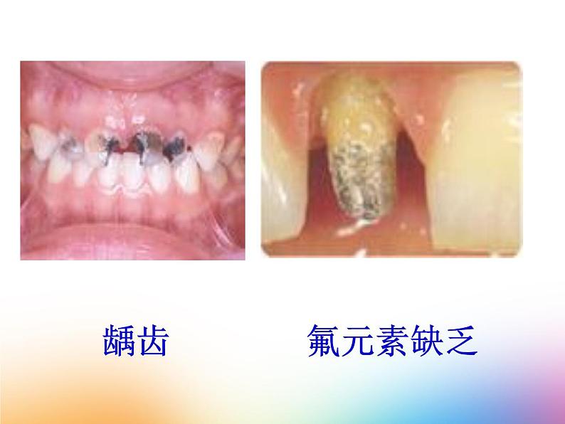 人教版初中化学九下12.2 化学元素与人体健康 课件  (5)第4页