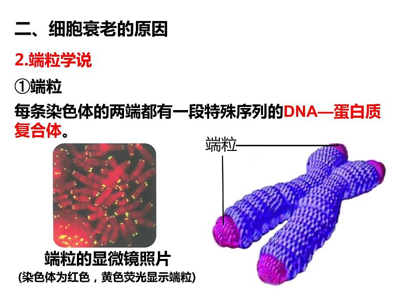 6.3 细胞的衰老和死亡 课件-【新教材】高一上学期生物人教版（2019）必修一07