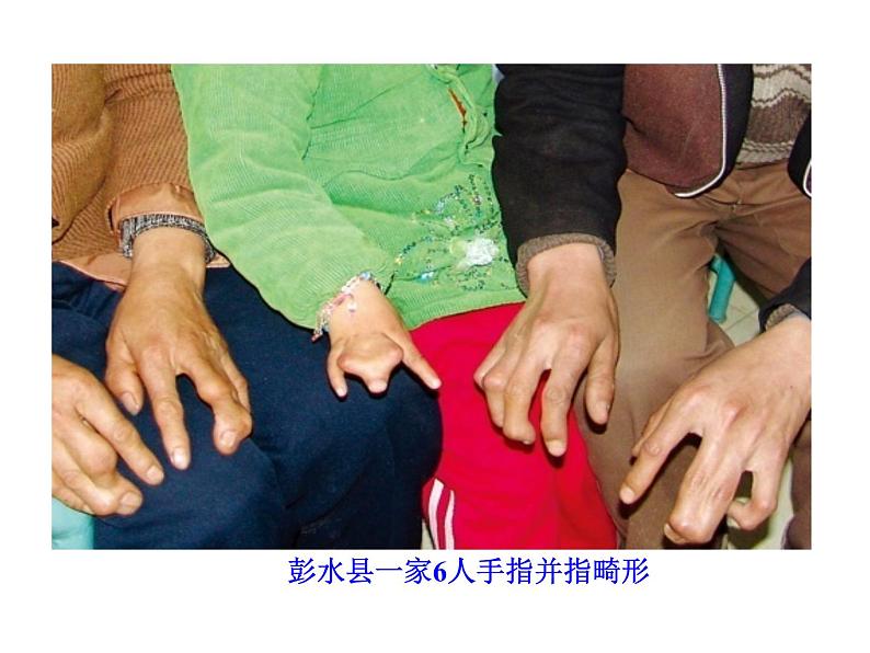 高中生物同步课件：第5章 第3节  人类遗传病（人教版必修2）03