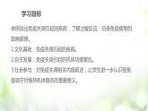 人教版2019选择性必修一4.3免疫失调课件PPT