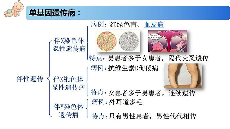 3.3 人类遗传病-2020-2021学年高一生物同步备课系列（新苏教版（2020）必修2）课件PPT07