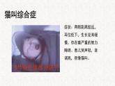 4.3.1 染色体畸变可能引起性状改变 课件-浙科版高中生物必修2遗传与进化(共27张PPT)