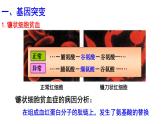 5.1基因突变和基因重组课件-2021-2022学年高一下学期生物人教版（2019）必修2