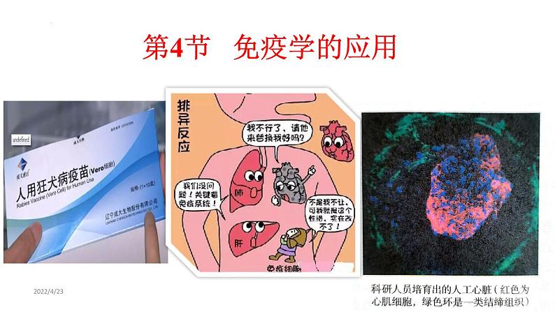 4.4免疫学的应用课件2021-2022学年高二上学期生物人教版选择性必修101