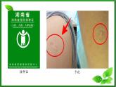 4.4免疫学的应用课件2021-2022学年高二上学期生物人教版选择性必修1