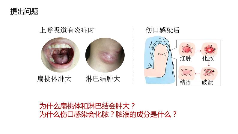 4.1免疫系统的组成和功能课件2021-2022学年高二上学期生物人教版选择性必修102