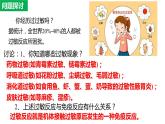 4.3免疫失调课件2021-2022学年高二上学期生物人教版选择性必修1