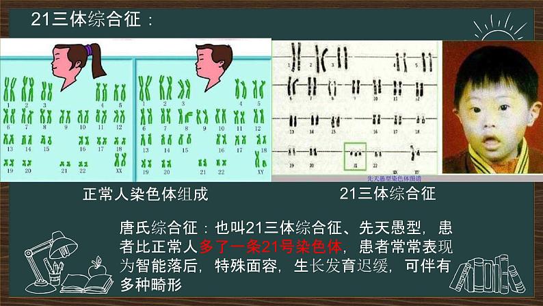 5.2染色体变异课件2021-2022学年高一下学期生物人教版必修2第5页