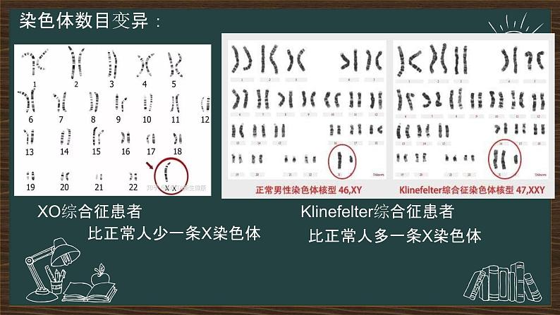 5.2染色体变异课件2021-2022学年高一下学期生物人教版必修2第7页