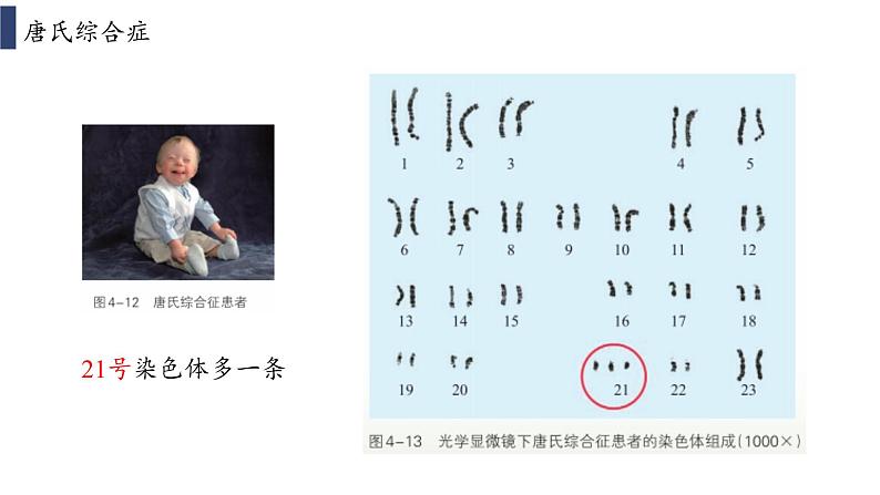 4.3.1 《染色体畸变可能引起性状改变》课件+教案03