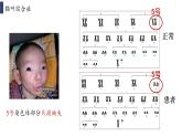 4.3.1 《染色体畸变可能引起性状改变》课件+教案