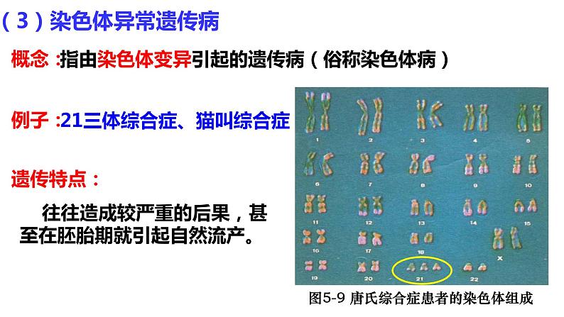 5.3人类遗传病课件-2021-2022学年高一下学期生物人教版（2019）必修205