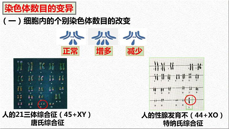 5.2染色体变异 第1课时 课件-2021-2022学年高一下学期生物人教版（2019）必修2第7页