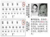 5.2 染色体变异  课件【新教材】2020-2021学年高一生物人教版（2019）必修二