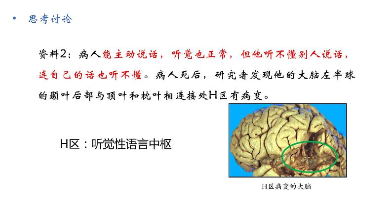 高中生物 人脑的高级功能 课件第8页