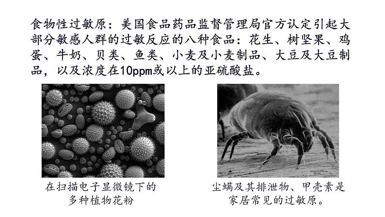 高中生物 免疫失调——免疫调节中的信息错乱 课件第7页