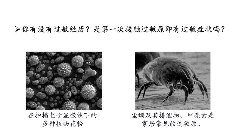 高中生物 免疫失调——免疫调节中的信息错乱 课件第8页