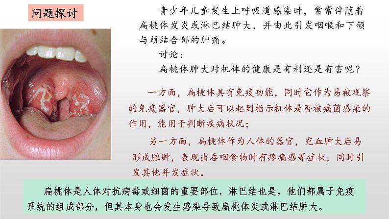 高中生物选择性必修一   4.1 免疫系统的组成和功能 课件05