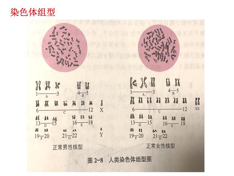 2023届高三一轮复习生物：染色体组型及伴性遗传课件第2页