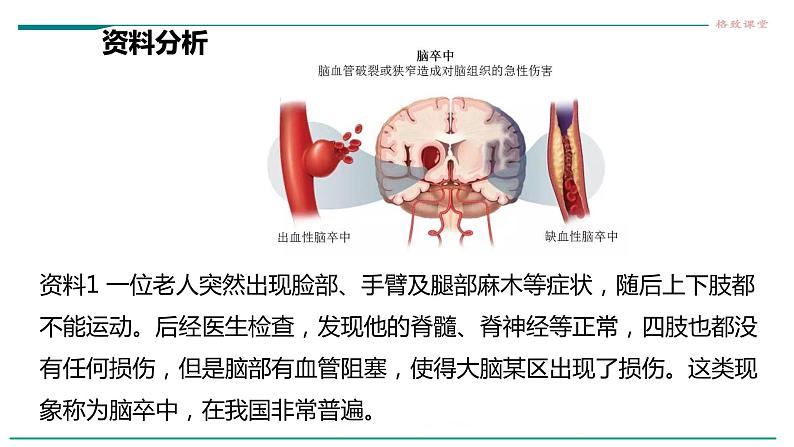 高中生物选择性必修一   第四节  神经系统的分级调节课件PPT第8页